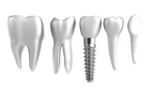 Northside Chicago Implant Dentistry