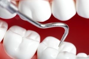 Cosmetic Dentist in West Ridge